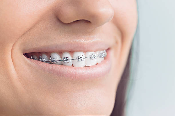 Best Dental Exams and Cleanings  in Malmstrom Af, MT